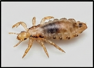 التخلص من القمل بطرق آمنة